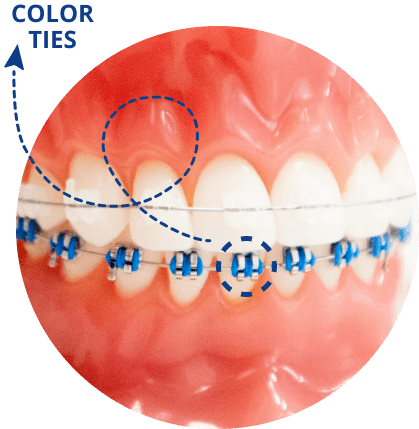 Color Ties Example