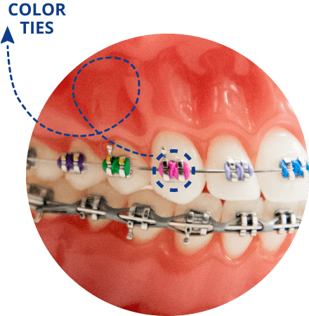 Color Ties Example