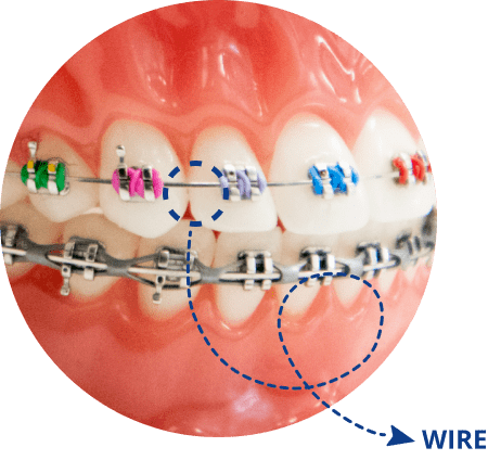 Wires Example